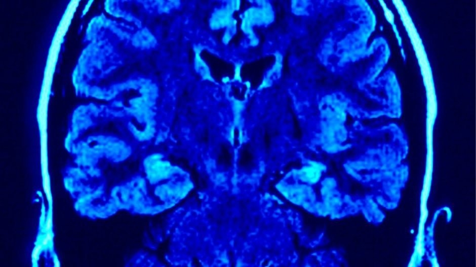 Naučnici presadili laboratorijski uzgojeno ljudsko moždano tkivo u miševe: Važan korak za istraživanje autizma, cerebralne paralize, epilepsije i šizofrenije